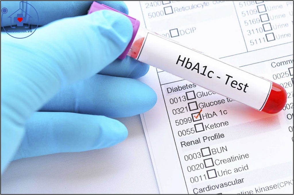 HbA1C là gì? Xét nghiệm HbA1C có lợi ích gì?