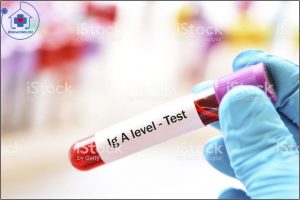 xét nghiệm IgA