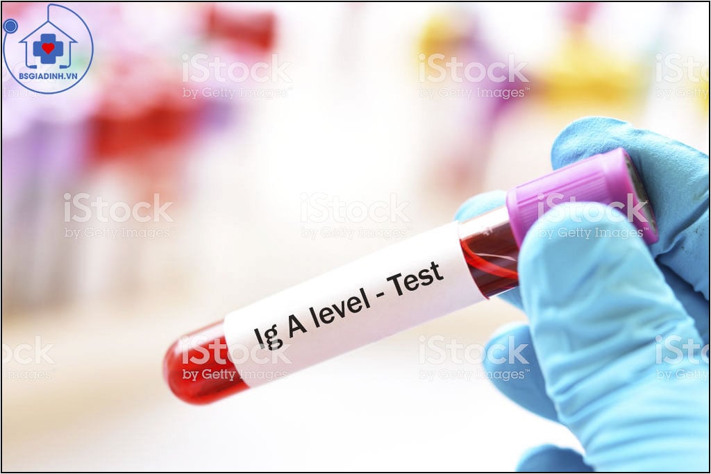 xét nghiệm IgA