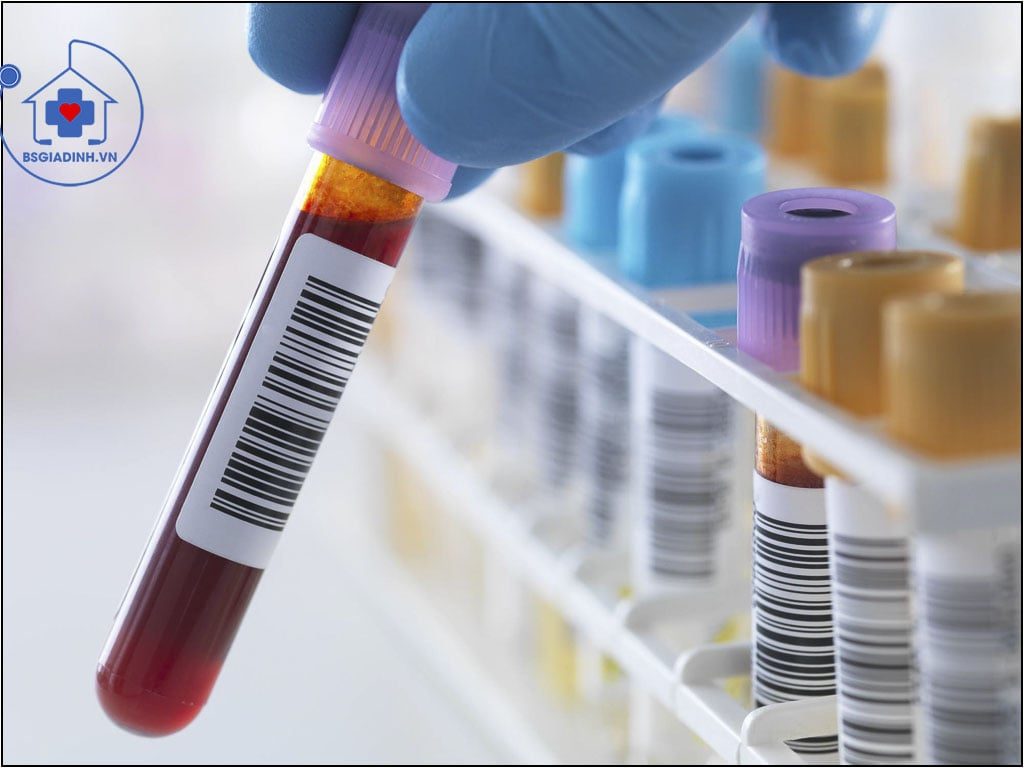 xét nghiệm IgM
