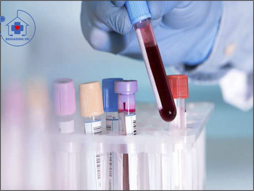 xét nghiệm IgM