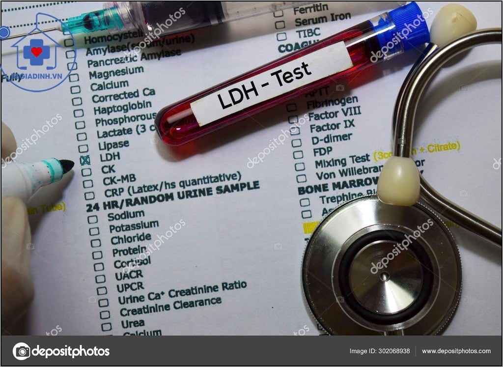 xét nghiệm LDH