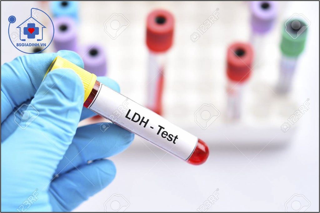 xét nghiệm LDH
