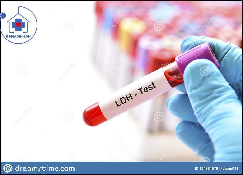 xét nghiệm LDH