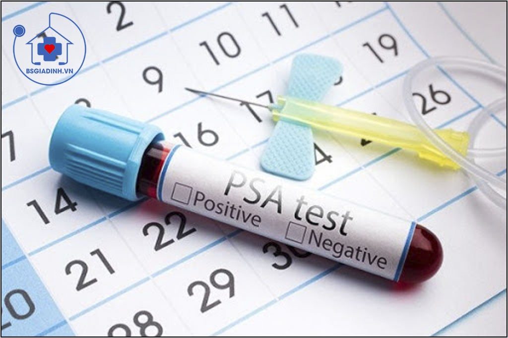 PSA là gì? Khi nào cần làm xét nghiệm PSA?