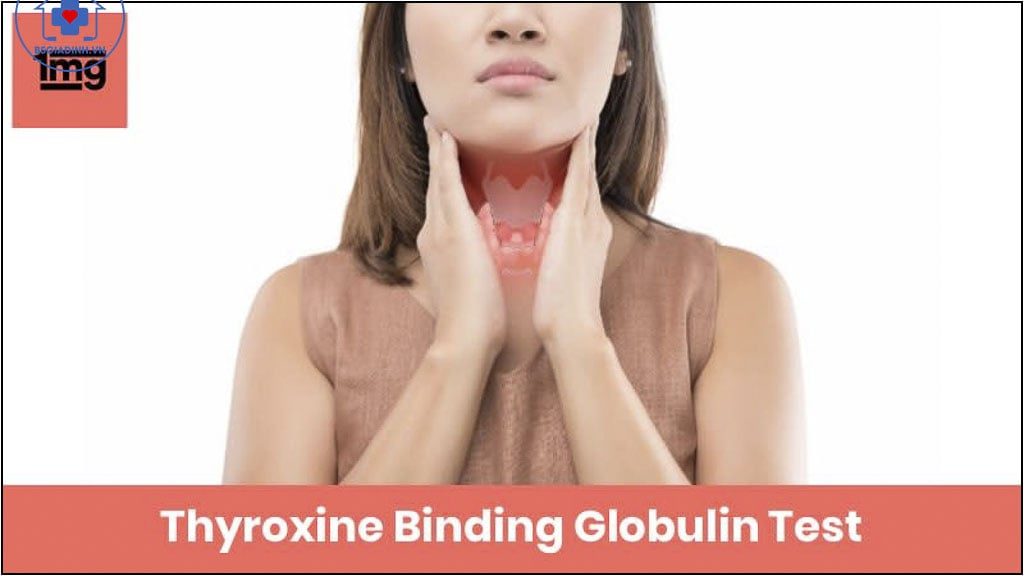Xét nghiệm TBG là gì? Khi nào cần làm xét nghiệm tbg?