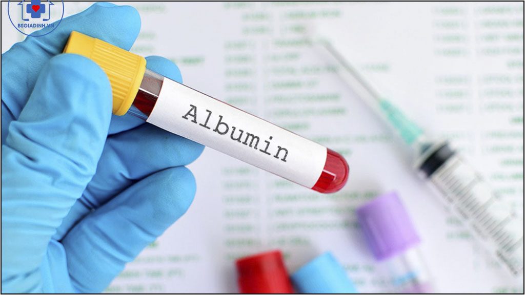 Xét nghiệm ALBUMIN là gì? Các trường hợp tăng giảm albumin máu.