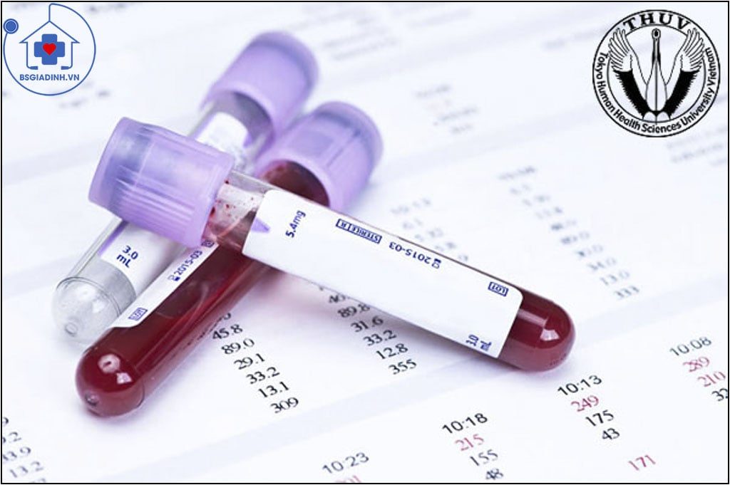 xét nghiệm bạch cầu