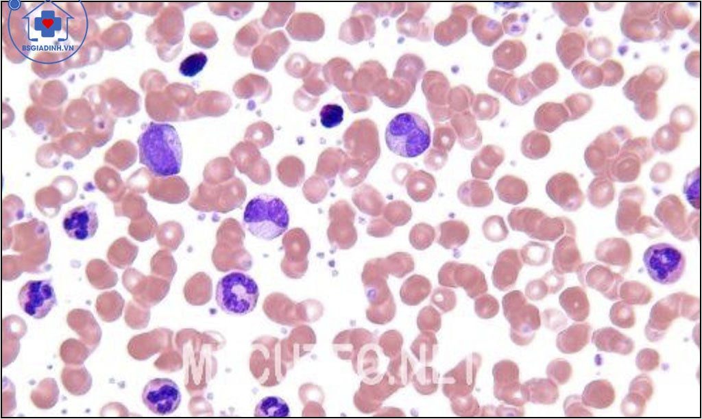 xét nghiệm bạch cầu