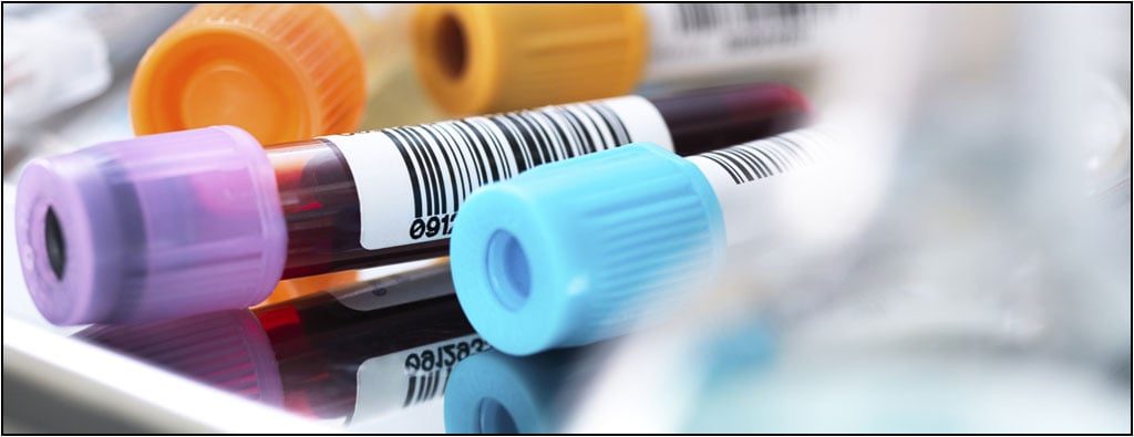 xét nghiệm bổ thể