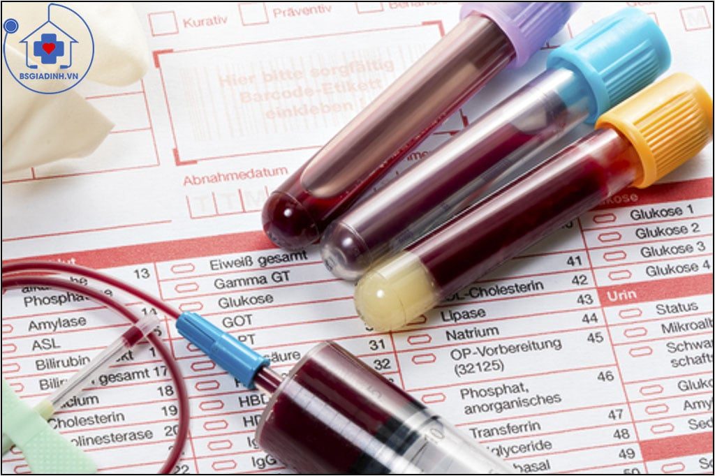 Xét nghiệm canxi máu và canxi niệu