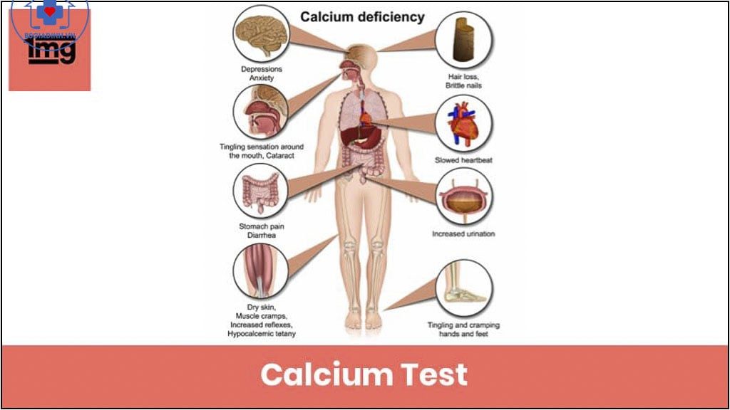 xét nghiệm canxi