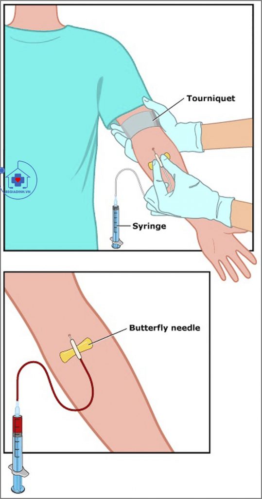 lấy mẫu xét nghiệm ggt