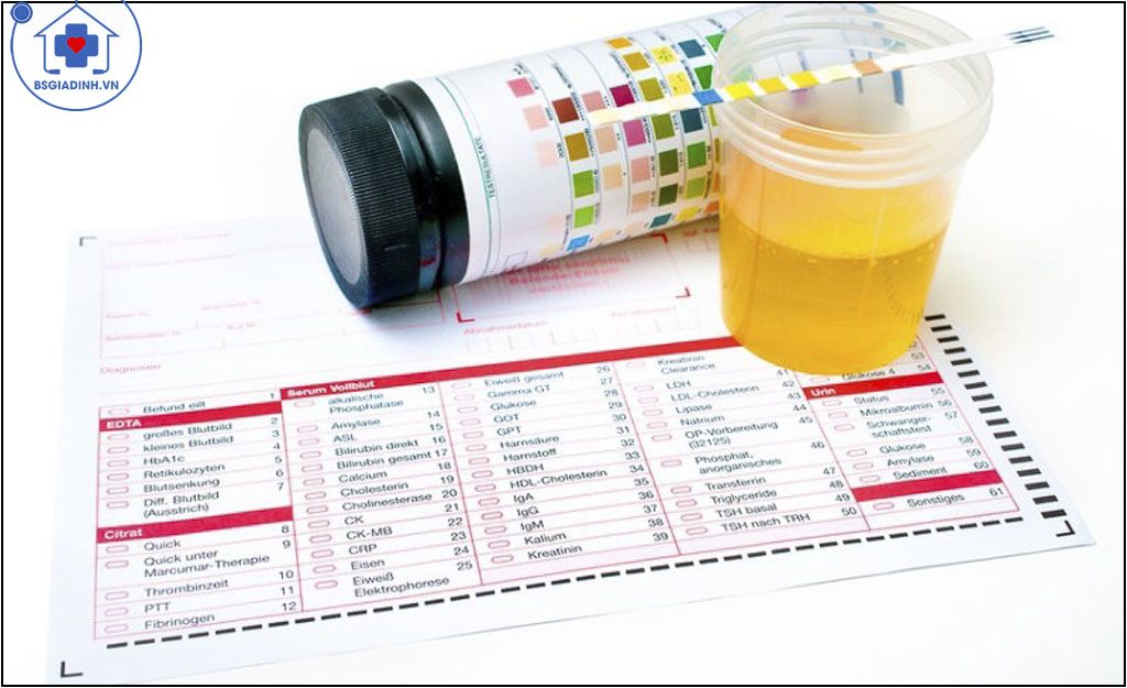 xét nghiệm glucose niệu
