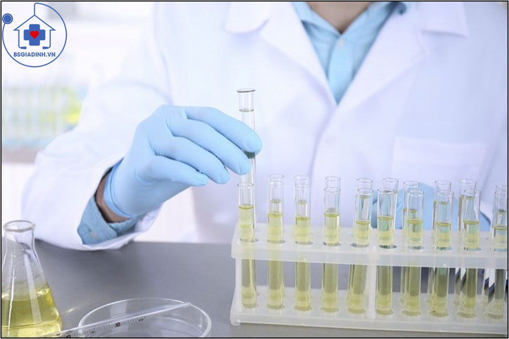 xét nghiệm glucose niệu