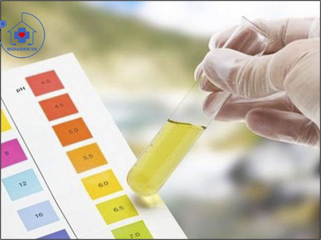 xét nghiệm glucose niệu