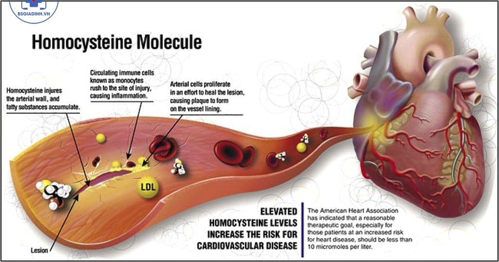 xét nghiệm Homocysteine
