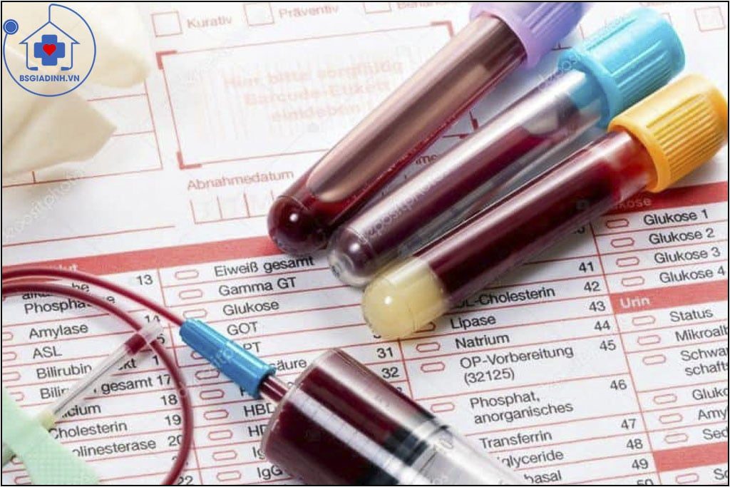 xét nghiệm kali máu