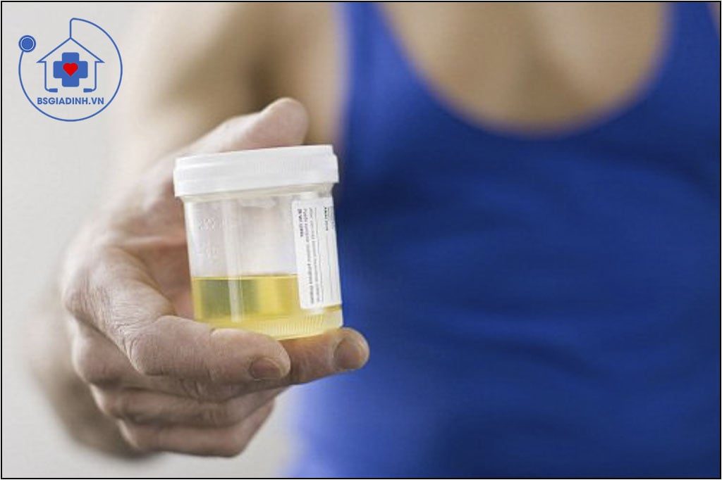 PREGNANETRIOL NIỆU