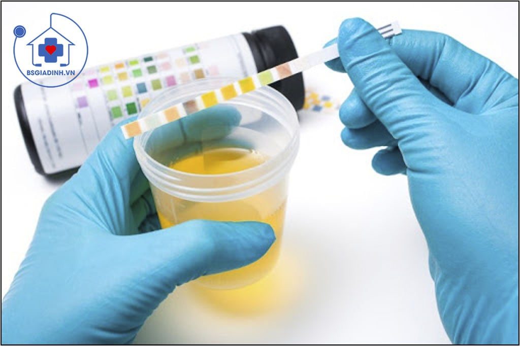 xét nghiệm kali trong nước tiểu