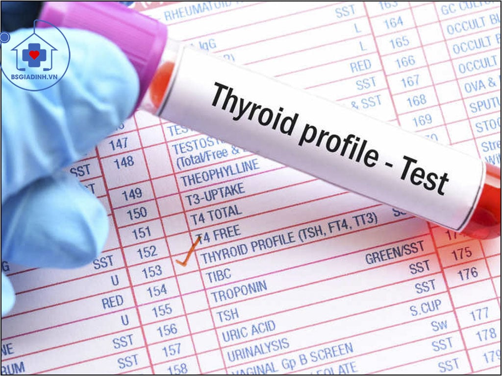 xét nghiệm TSH