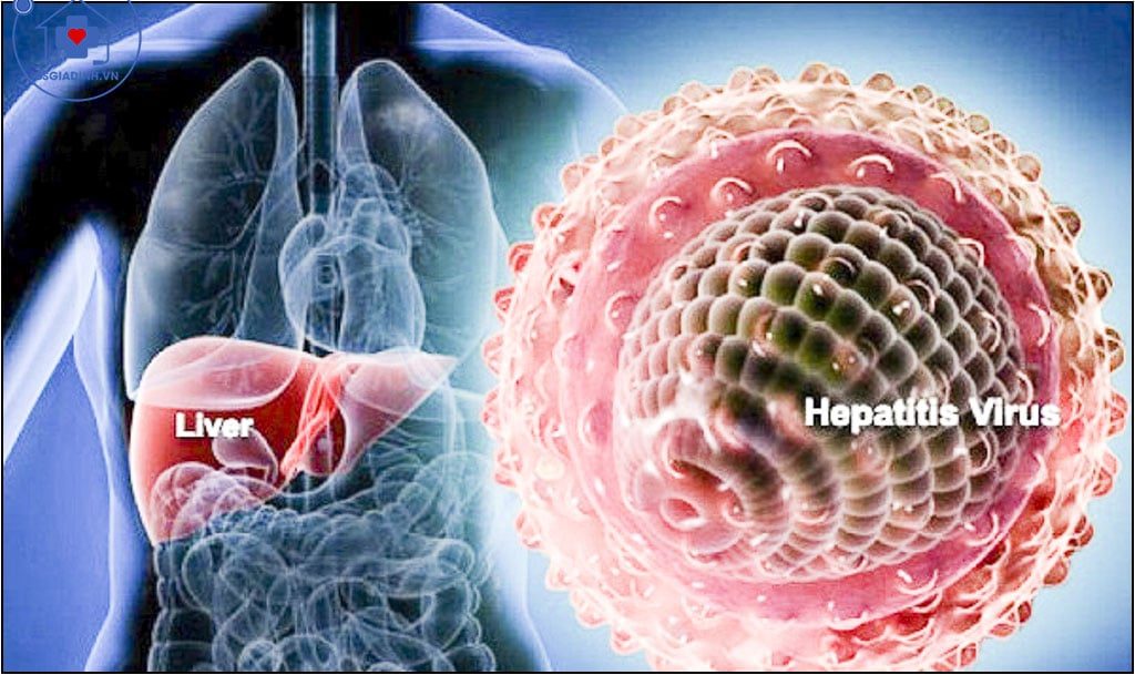 xét nghiệm viêm gan siêu vi