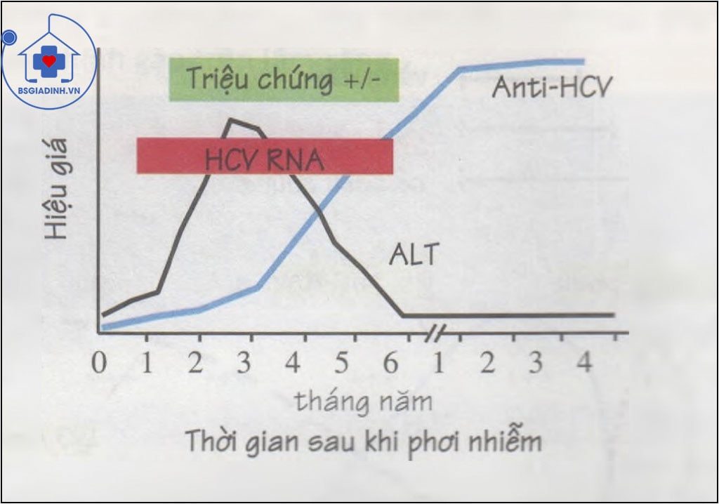 Viêm gan c cấp tính 
