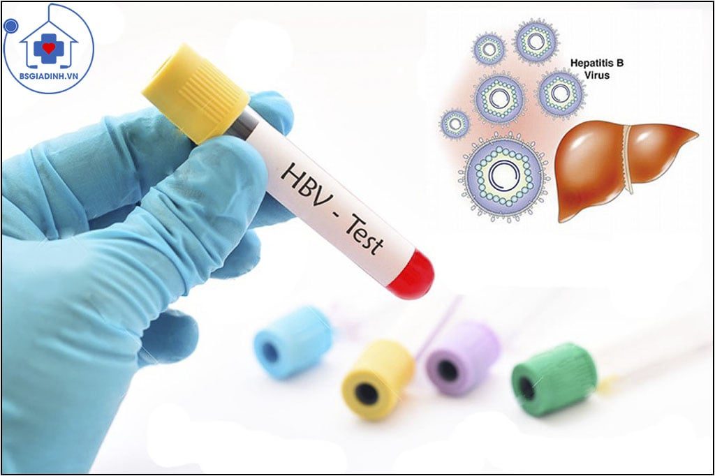Xét nghiệm viêm gan siêu vi B – những điều cần biết
