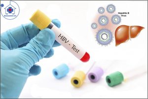 xét nghiệm viêm gan siêu vi B