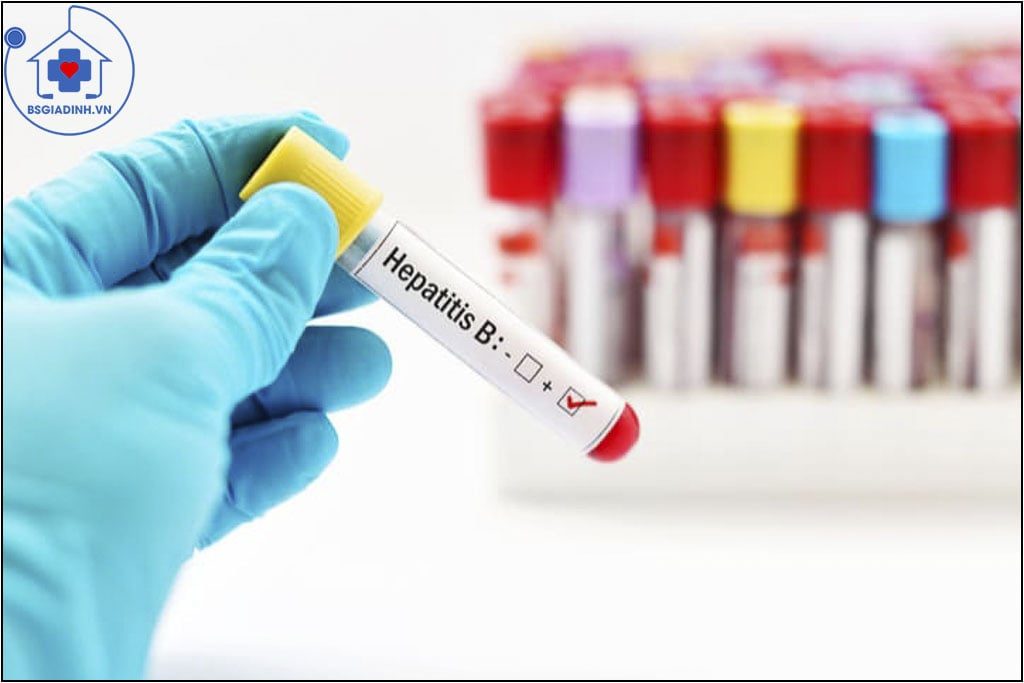xét nghiệm viêm gan siêu vi B