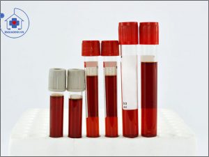 xét nghiệm rbc