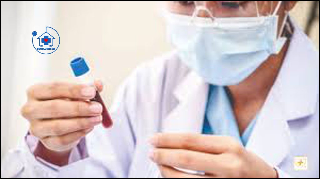 Xét nghiệm T4 toàn phần