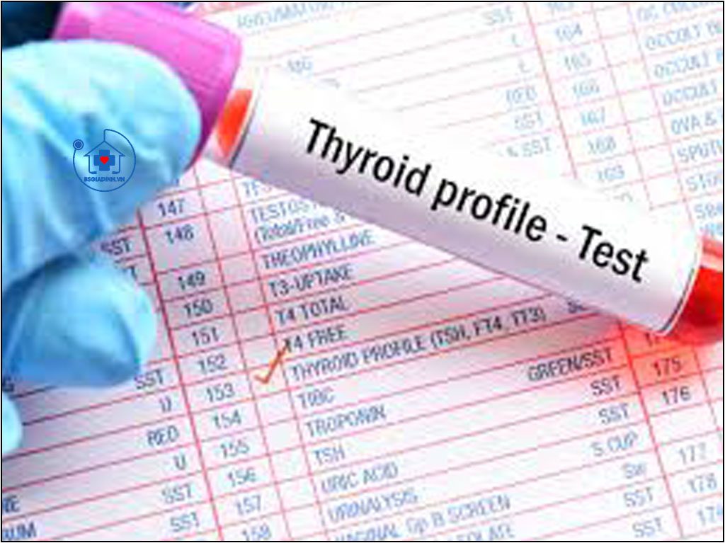 Xét nghiệm T4 tự do