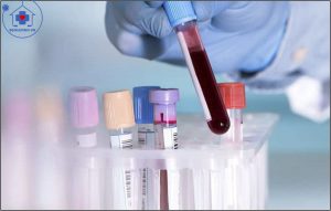 độ nhớt của máu