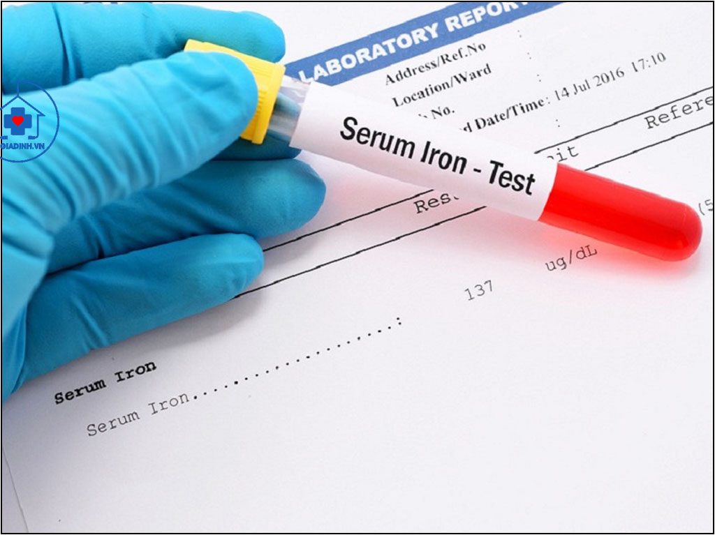 TEST ĐÁNH GIÁ KHẢ NĂNG MANG SẮT TOÀN THỂ