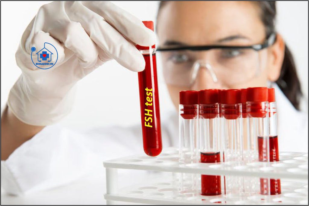 HORMON KÍCH THÍCH TAO NANG TRỨNG (FSH)