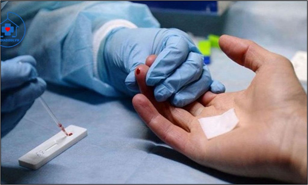 HUYẾT THANH HỌC CHẨN ĐOÁN HIV
