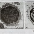 hình ảnh tế bào lympho