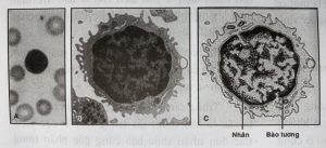 hình ảnh tế bào lympho