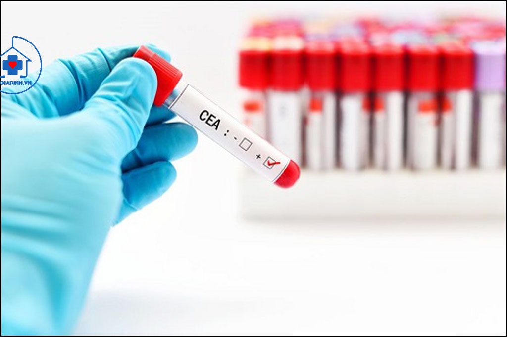 KHÁNG NGUYÊN UNG THƯ BIỂU MÔ PHÔI