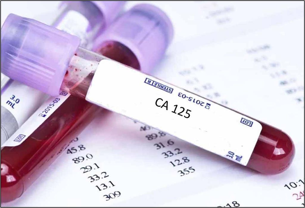 KHÁNG NGUYÊN UNG THƯ CA 125