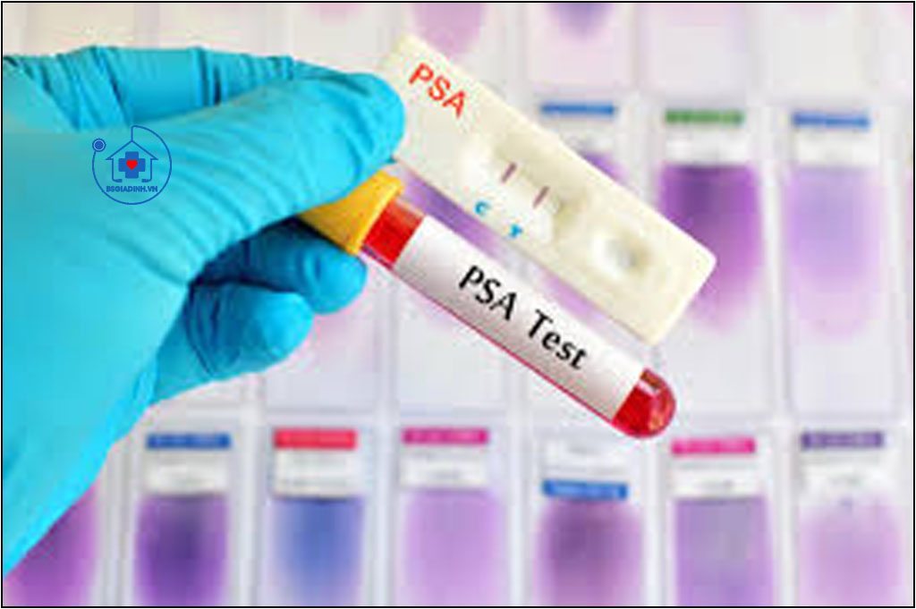 KHÁNG NGUYÊN ĐẶC HIỆU TUYẾN TIỀN LIỆT (PSA)