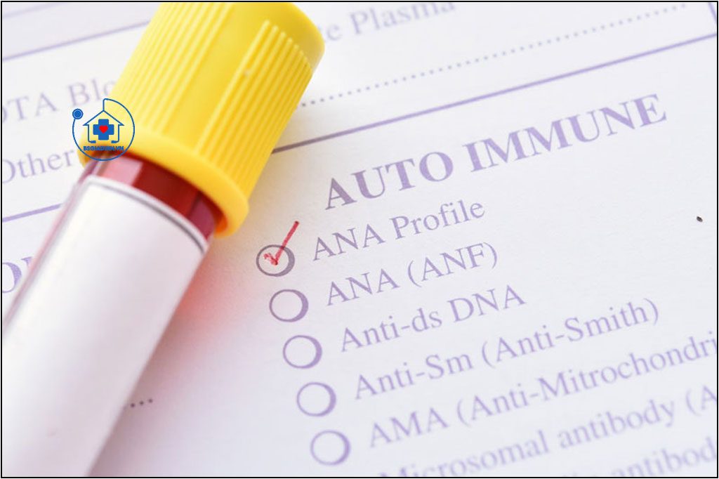 KHÁNG THỂ KHÁNG NHÂN (ANA)