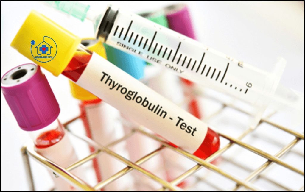 KHÁNG THỂ KHÁNG THYROGLOBULIN